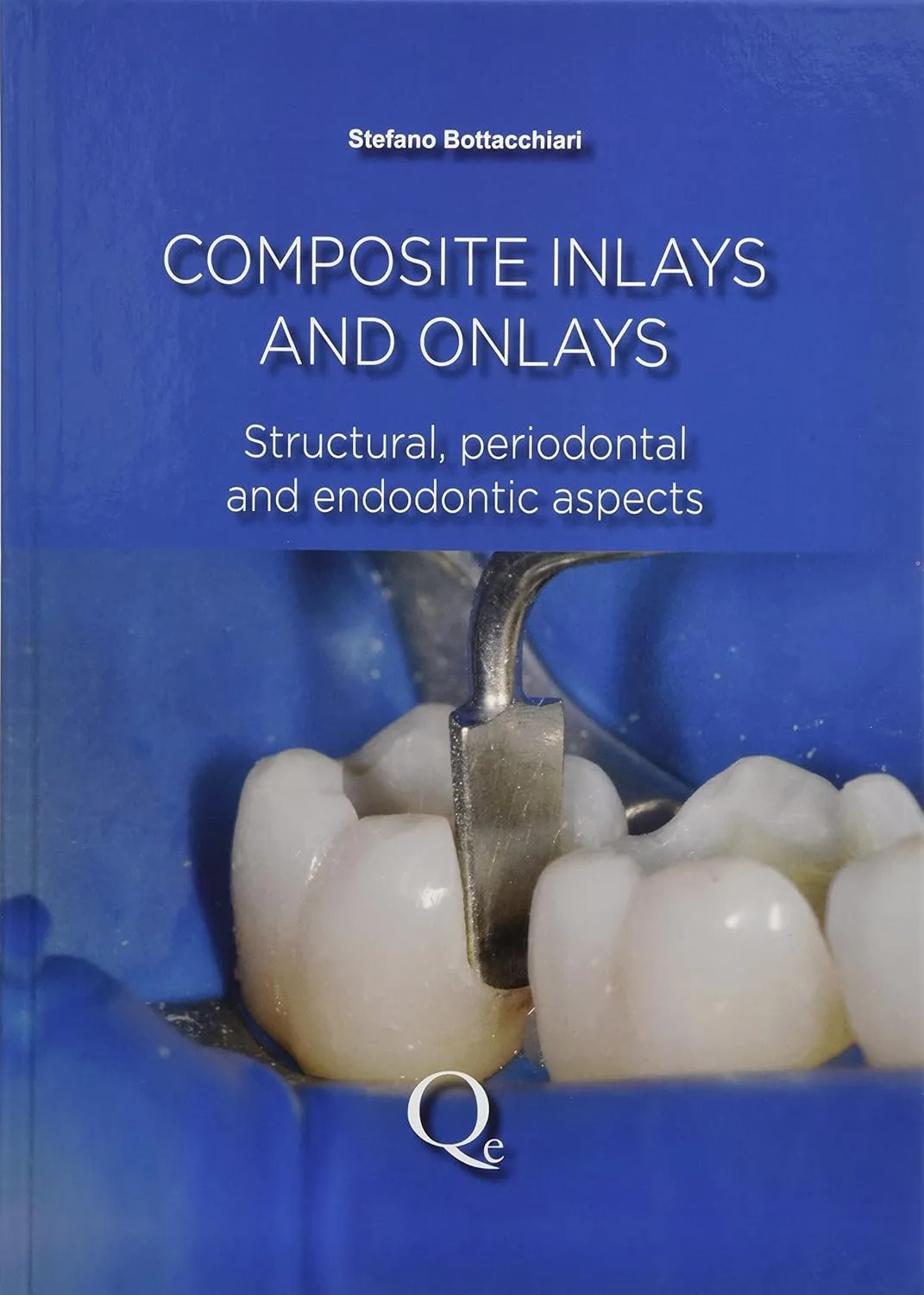 Composite Inlays and Onlays | Hardcover