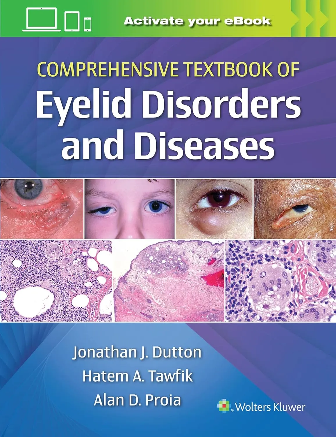 Comprehensive Textbook Of Eyelid Disorders And Diseases With Access Code | Hardcover