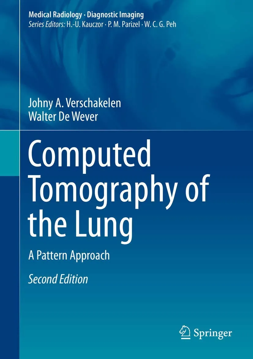 Computed Tompgraphy of the Lung | 2nd Edition | Hardcover