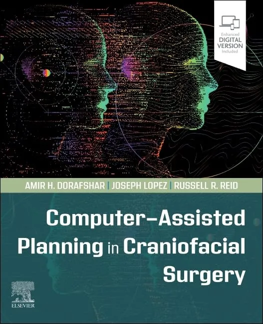 Computer Assisted Planning In Craniofacial Surgery With Access Code | Paperback