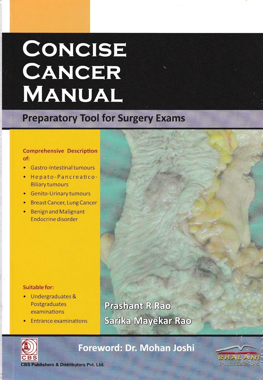 Concise Cancer Manual | Paperback
