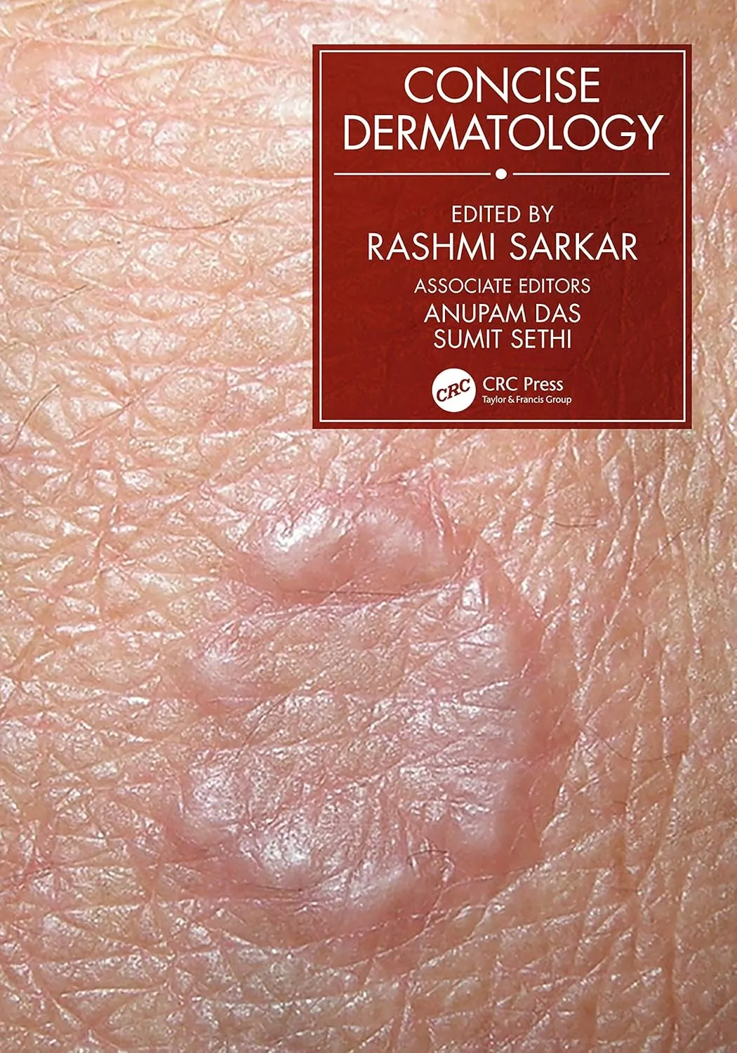 Concise Dermatology | Paperback