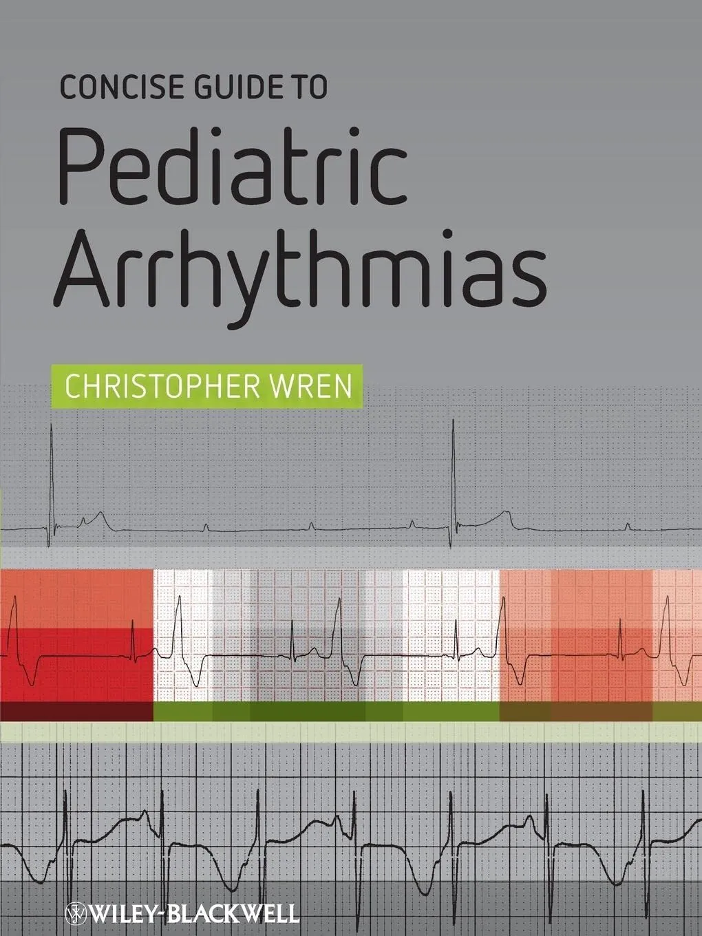 Concise Guide to Pediatric Arrhythmias | Paperback