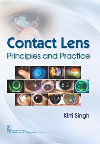 Contact Lens Principles and Practice | Paperback