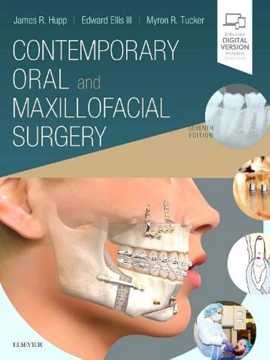 Contemporary Oral and Maxillofacial Surgery | 7th Edition | Hardcover