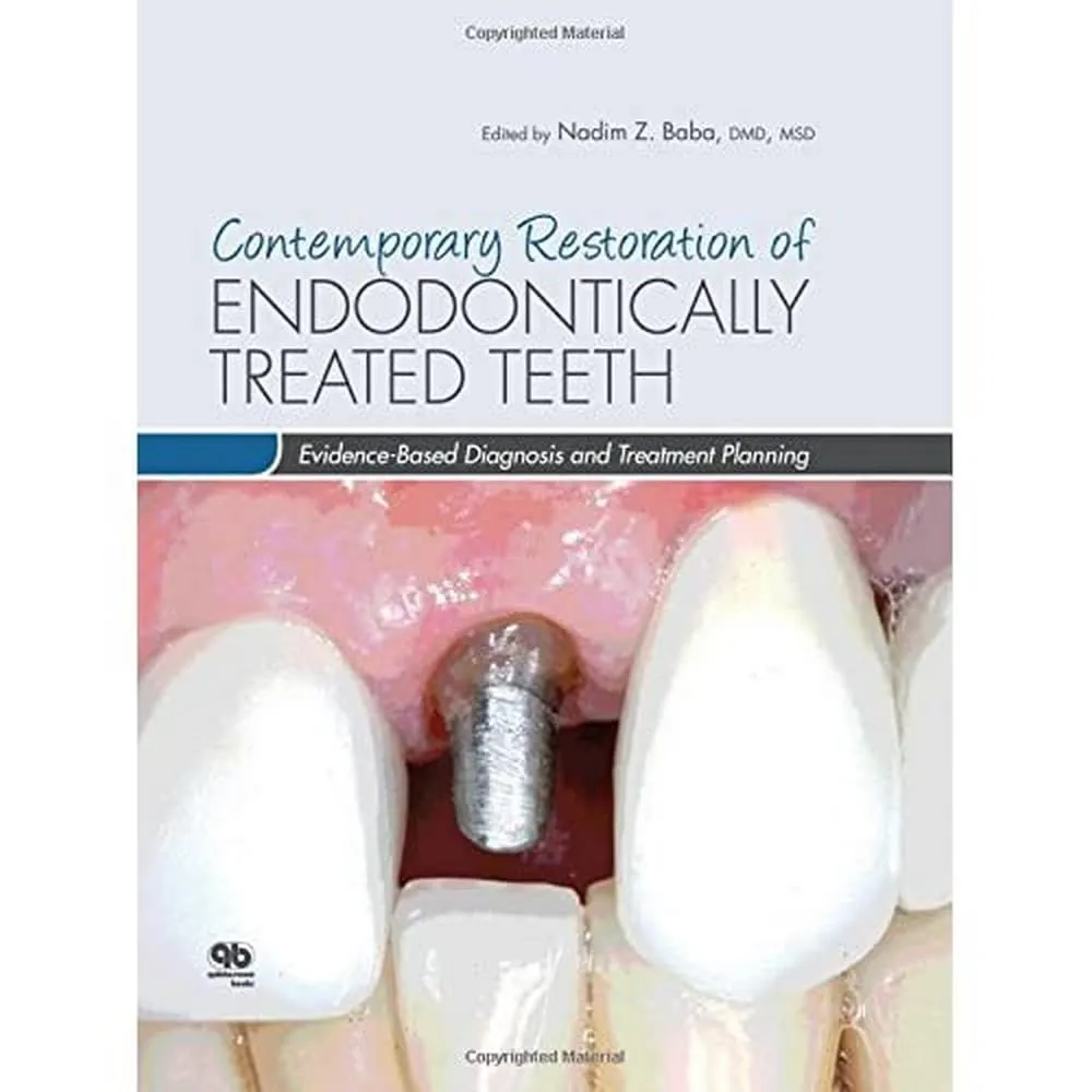 Contemporary Restoratin of Endodontically Treated Teeth | Hardcover