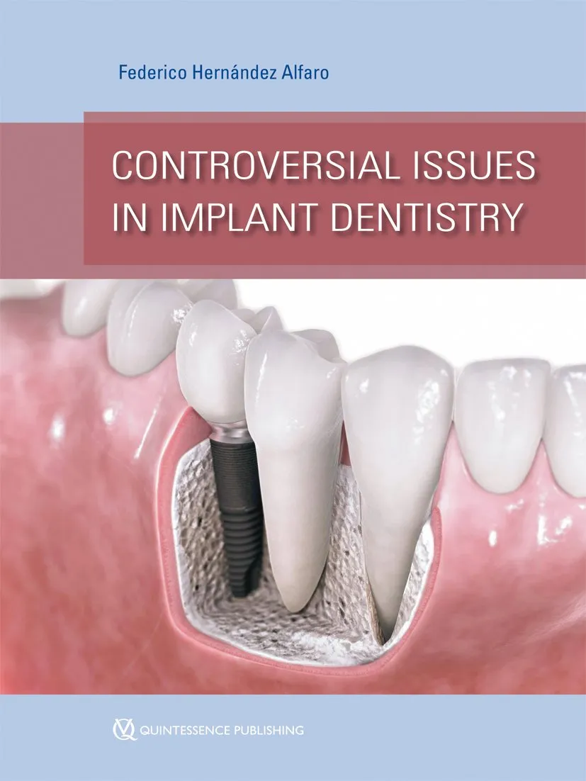 Controversial Issues in Implant Dentistry | Hardcover