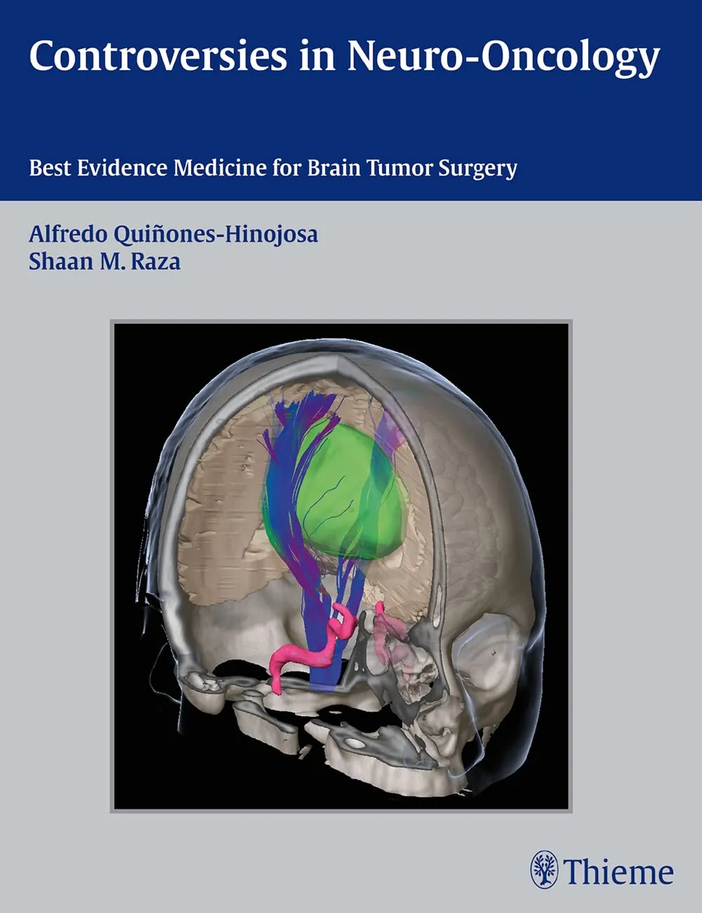 Controversies In Neuro Oncology Best Evidence Medicine For Brain Tumor Surgery | Hardcover