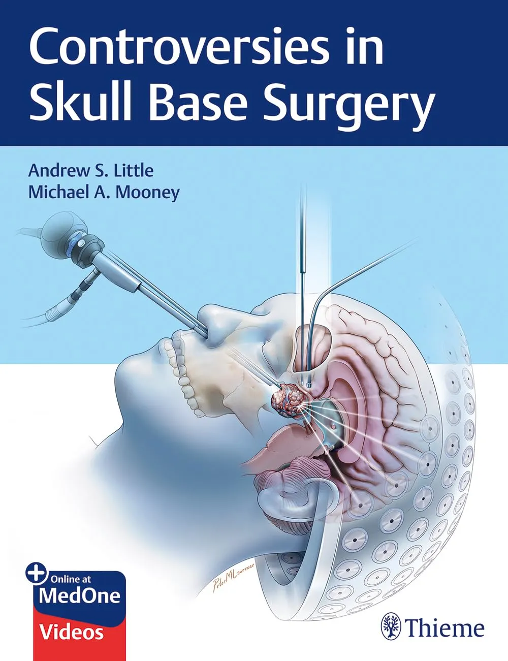 Controversies in Skul Base Surgery | Hardcover