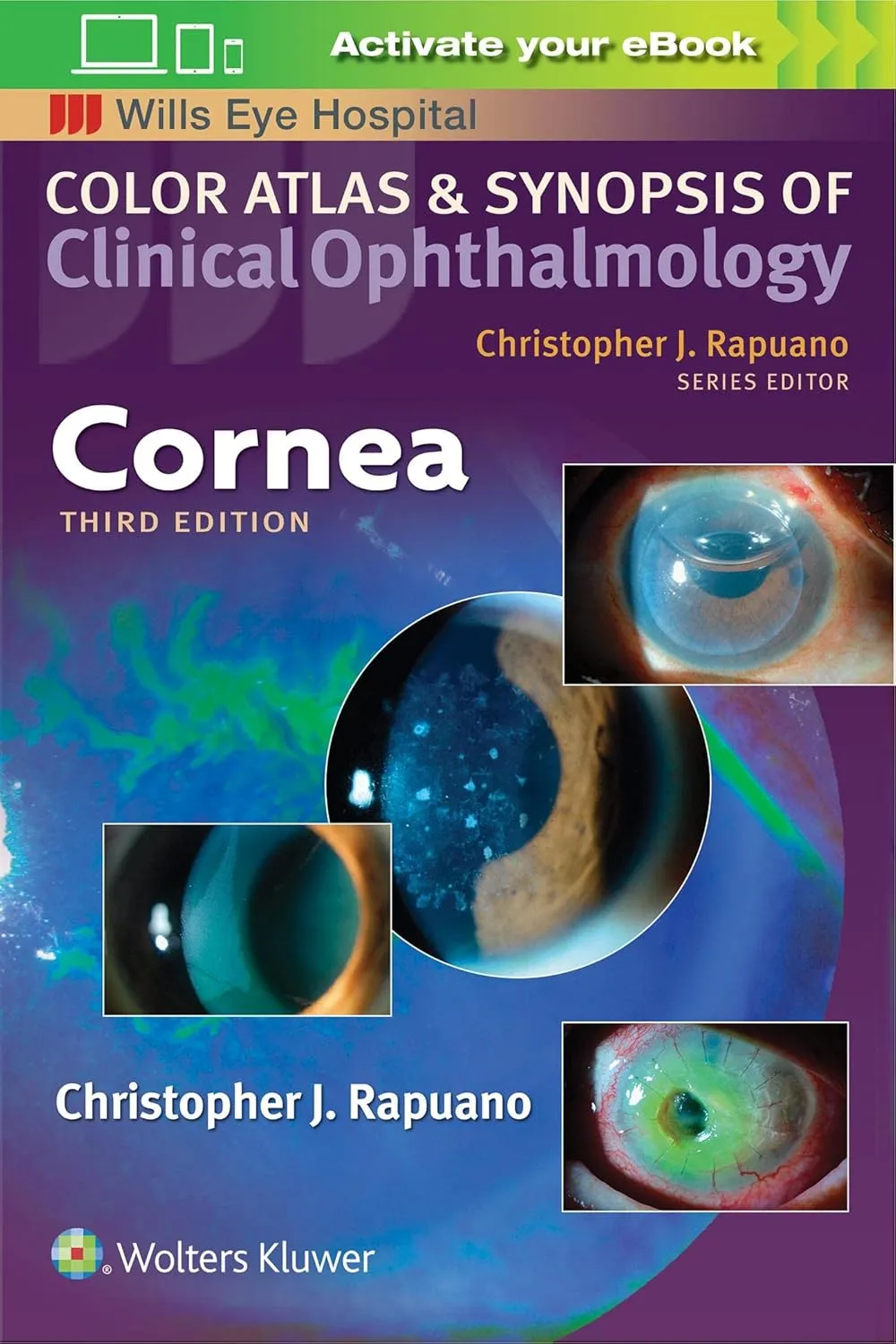 Cornea Color Atlas And Synopsis Of Clinical Ophthalmology Third Edition | Paperback
