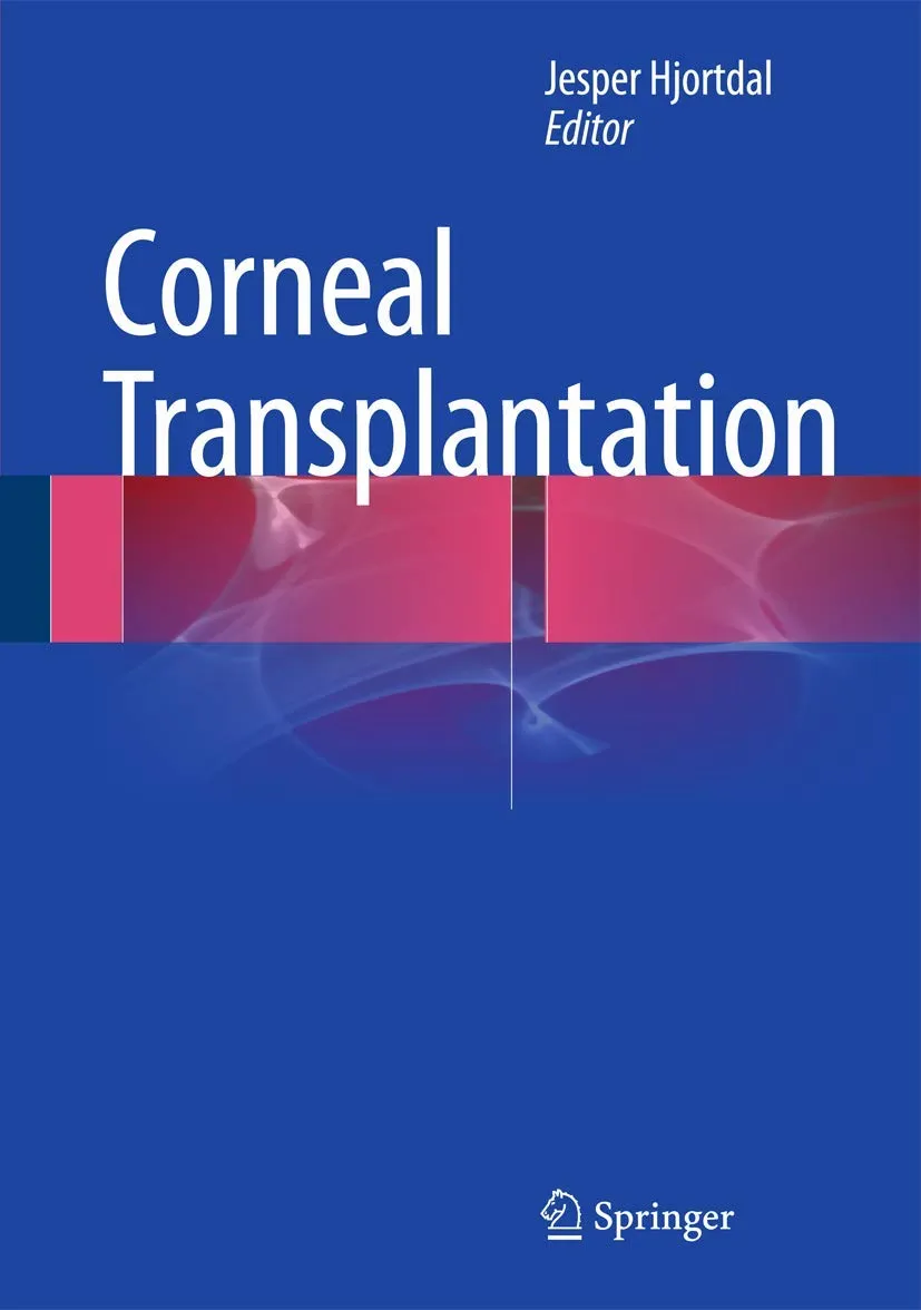 Corneal Transplantation | 1st Edition | Hardcover