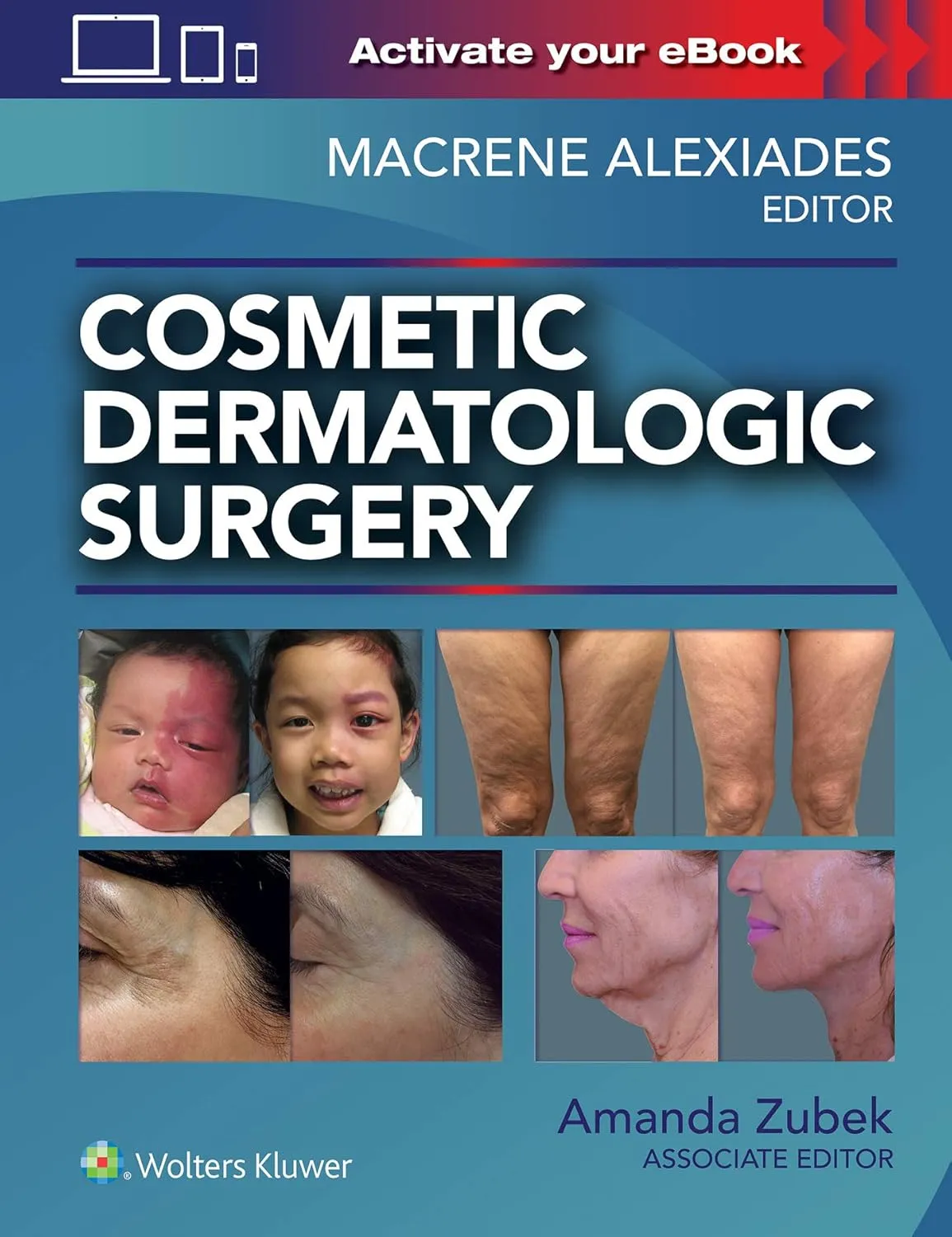 Cosmetic Dermatologic Surgery | Hardcover
