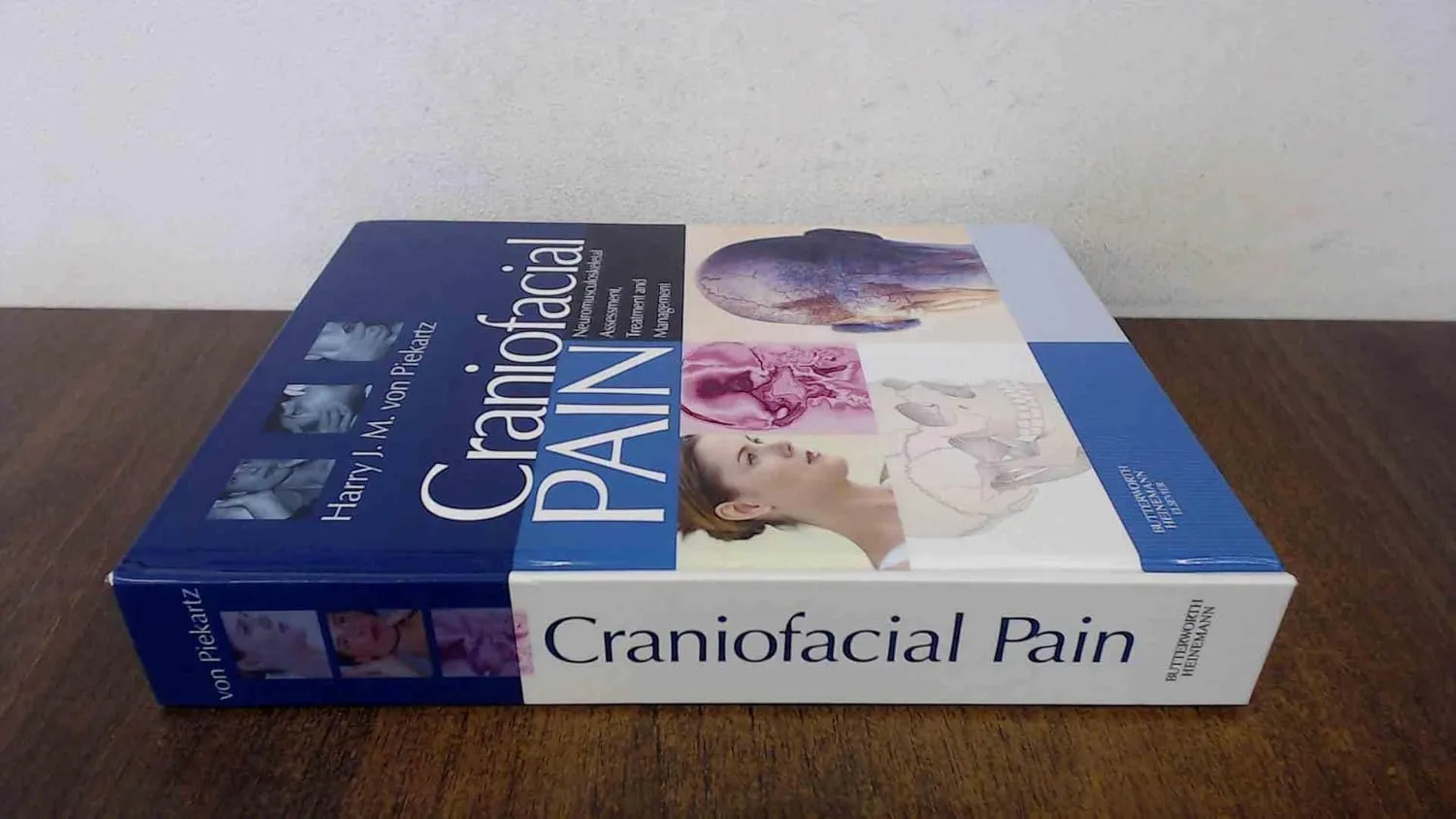 Craniofacial Pain | Hardcover