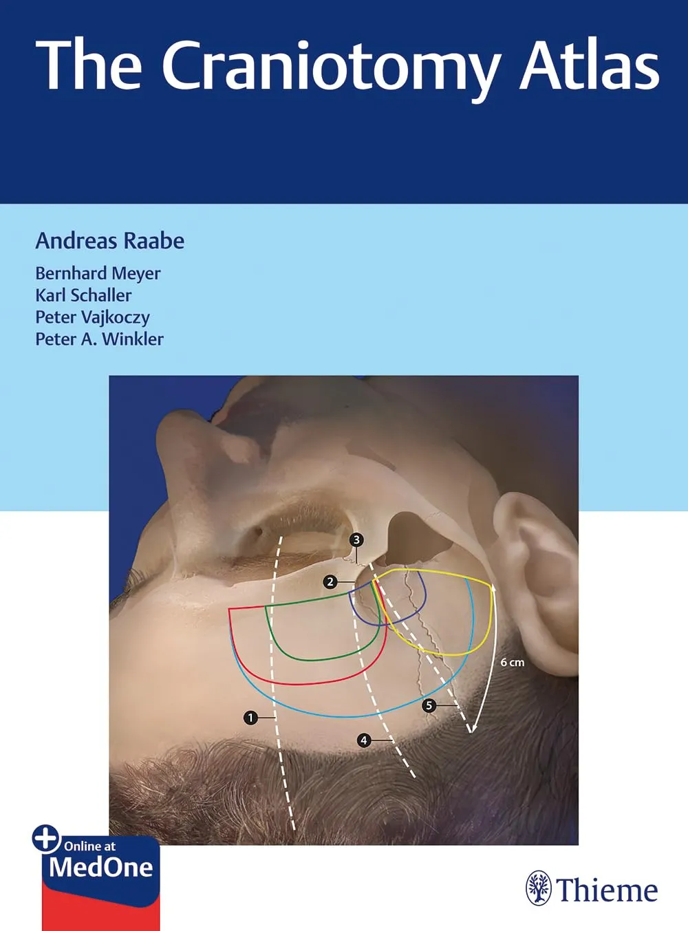 The Craniotomy Atlas | Hardcover