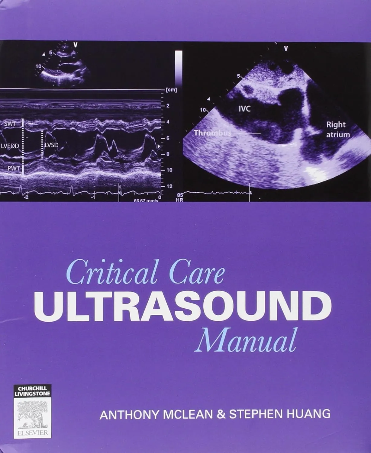 Critical Care Ultrasound Manual | Paperback