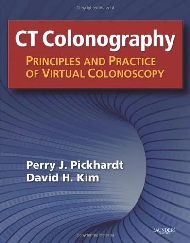 CT Colonography Principles and Practice of Virtual Colonoscopy | Hardcover