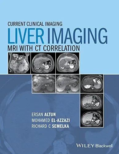 Current Clinical Imaging Liver Imaging | MRI with CT Correlation | 1st Edition | Hardcover