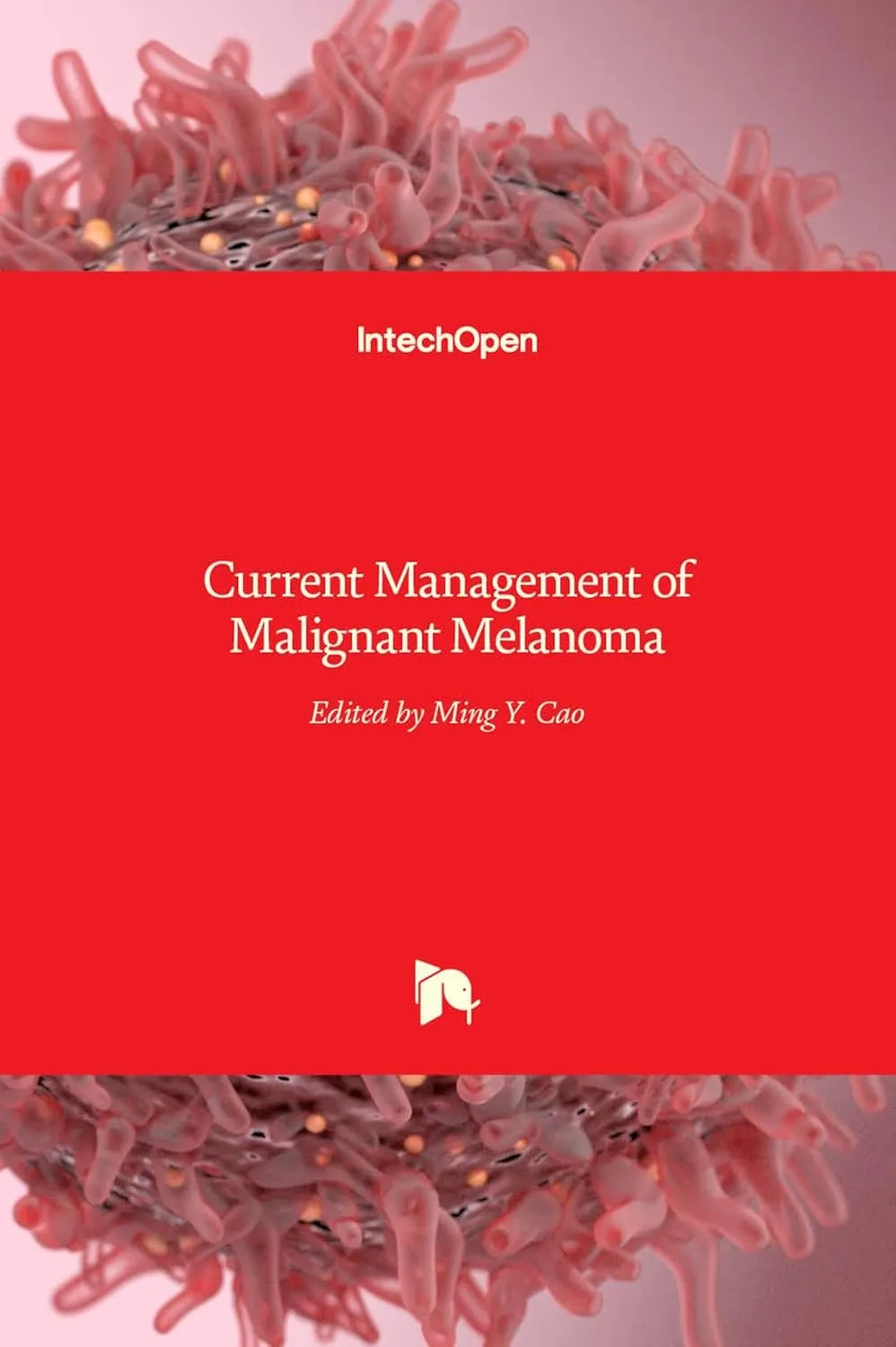 Current Management of Malignant Melanoma
