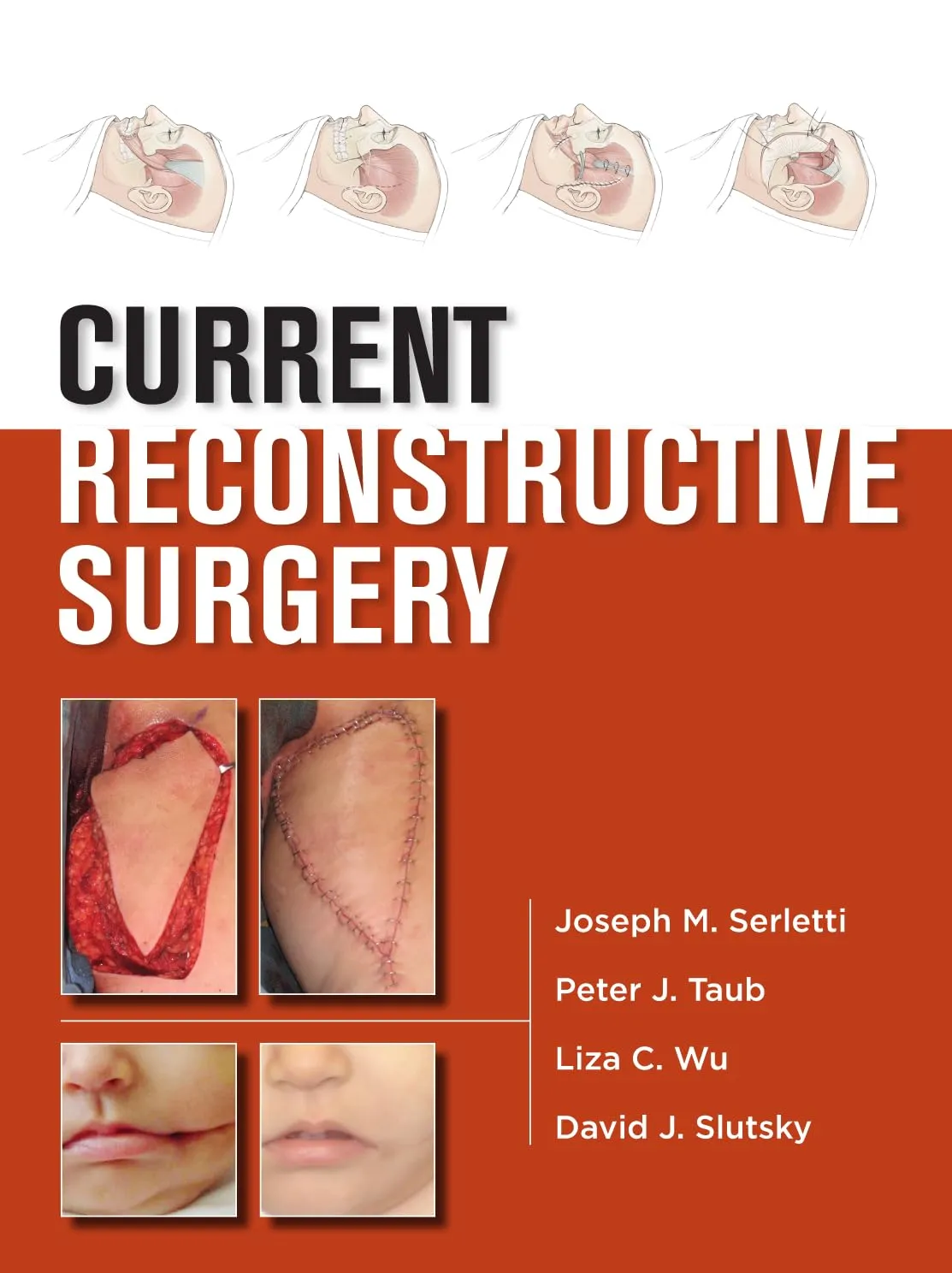 Current Reconstructive Surgery | Hardcover