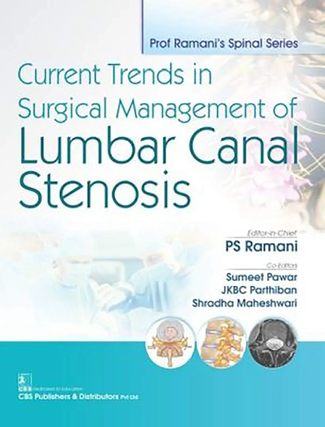 Current Trends In Surgical Management of Lumbar Canal Stenosis | Paperback