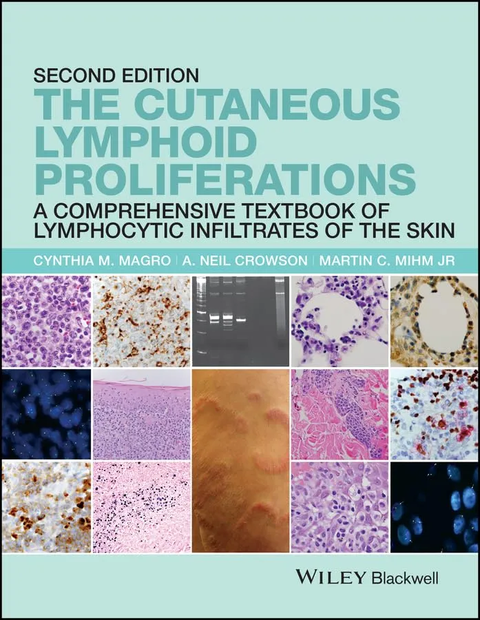 The Cutaneous Lymphoid Proliferations | 2nd Edition | Hardcover