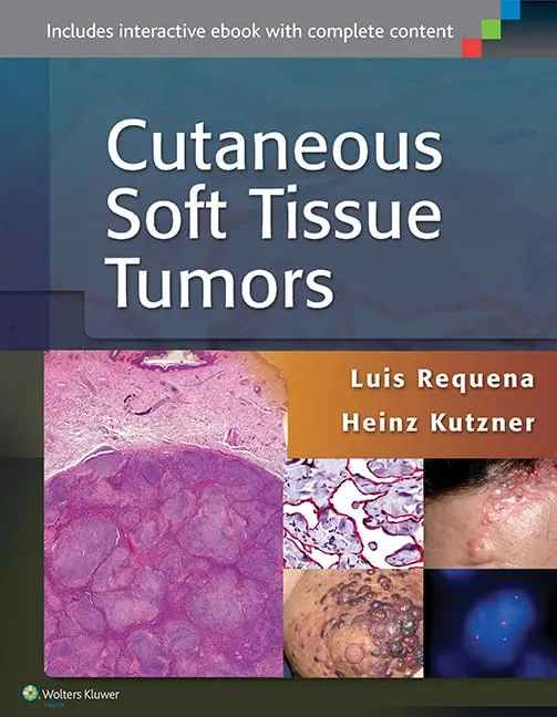 Cutaneous Soft Tissue Tumors | Hardcover