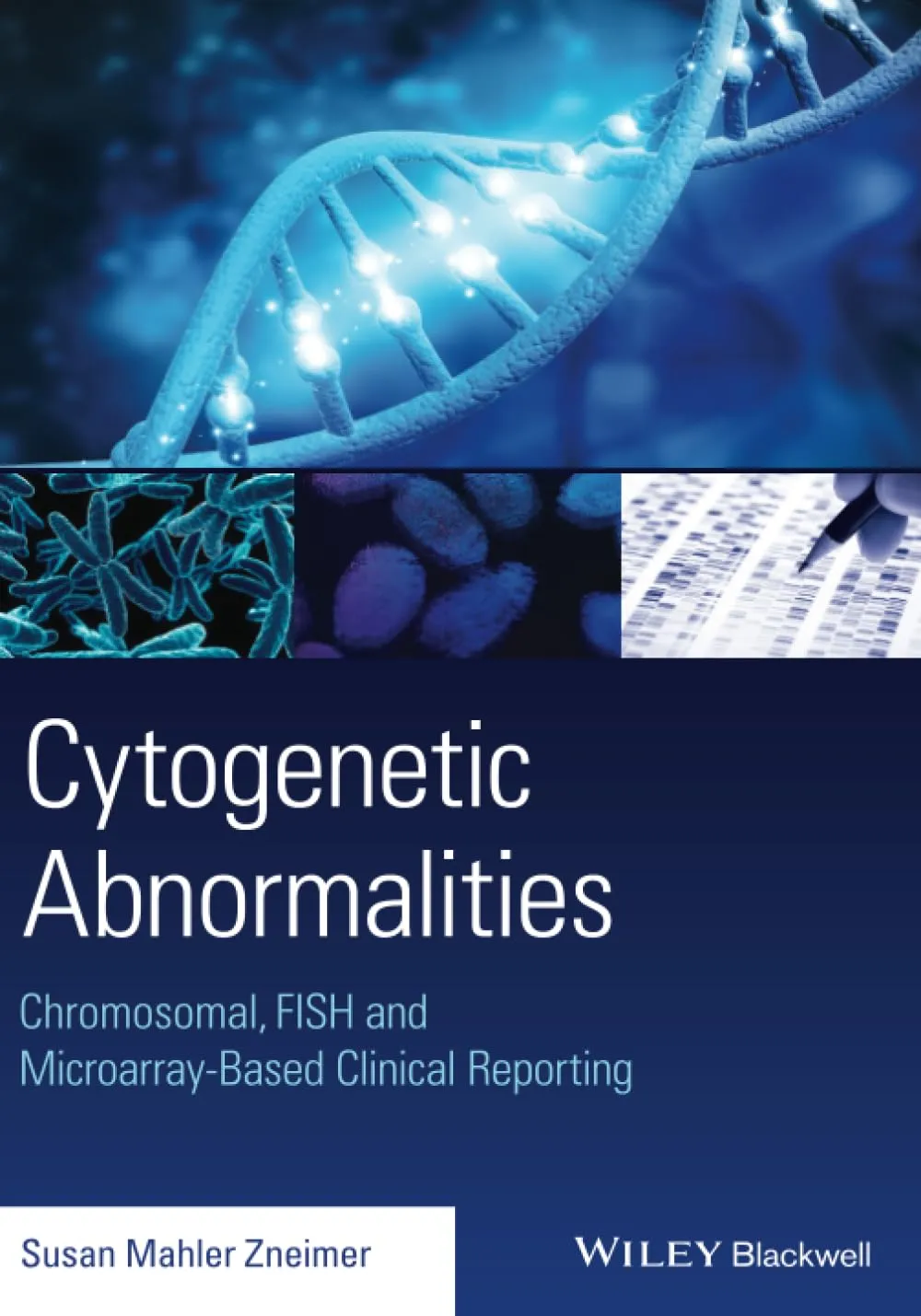Cytogenetic Abnormalities Chromosomal | Fish and Microarray-Based Clinical Reporting | Paperback