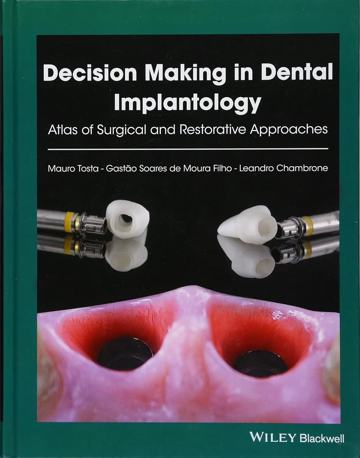 Decision Making in Dental Implantology | Hardcover
