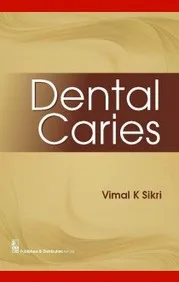 Dental Caries | Paperback