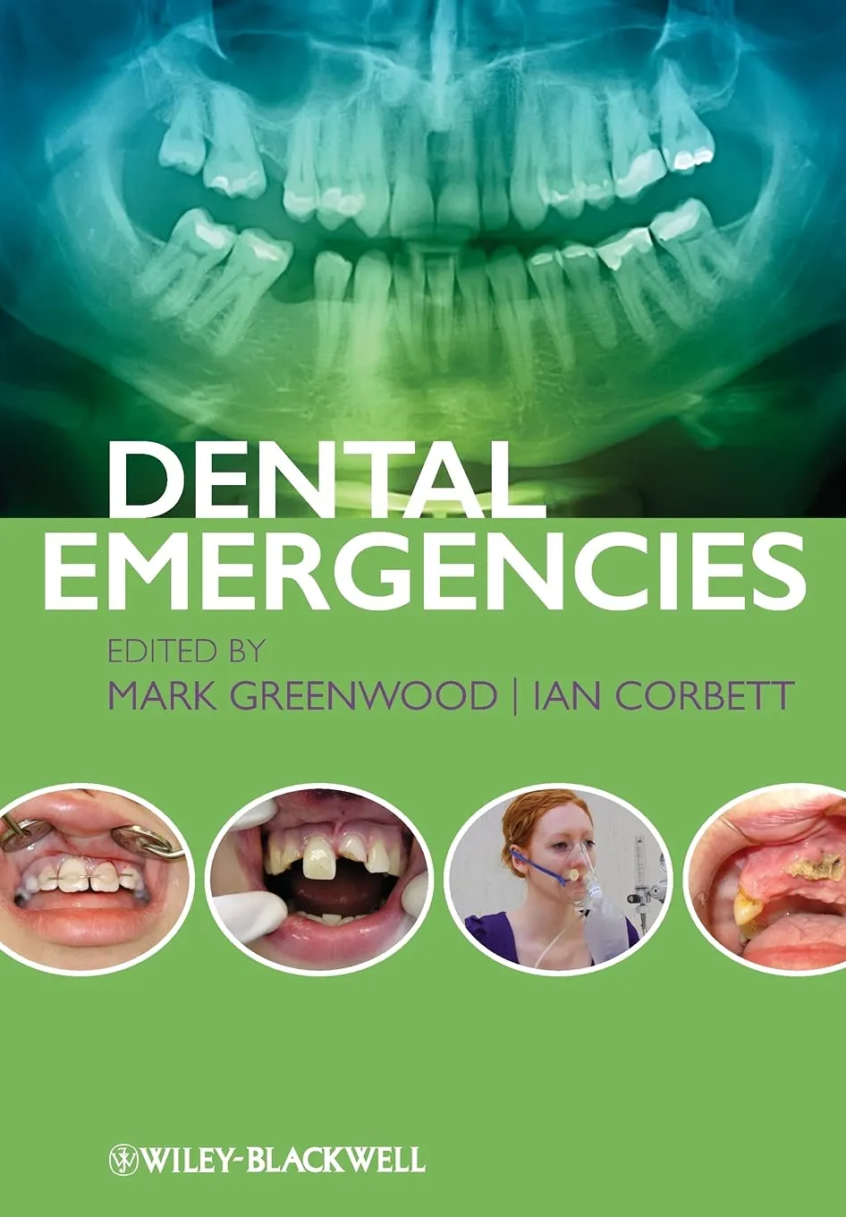 Dental Emergencis | Paperback