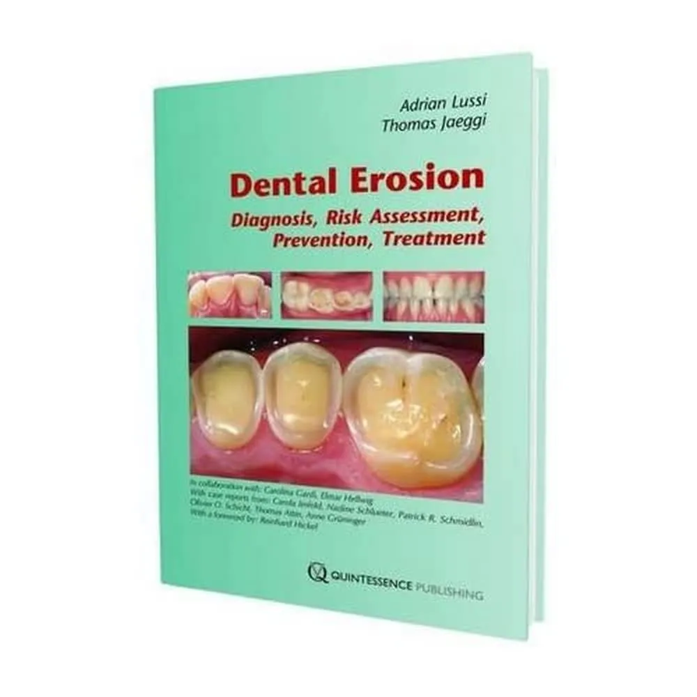 Dental Erosion Diagnosis | Risk Assessment | Prevention | Treatment | Hardcover