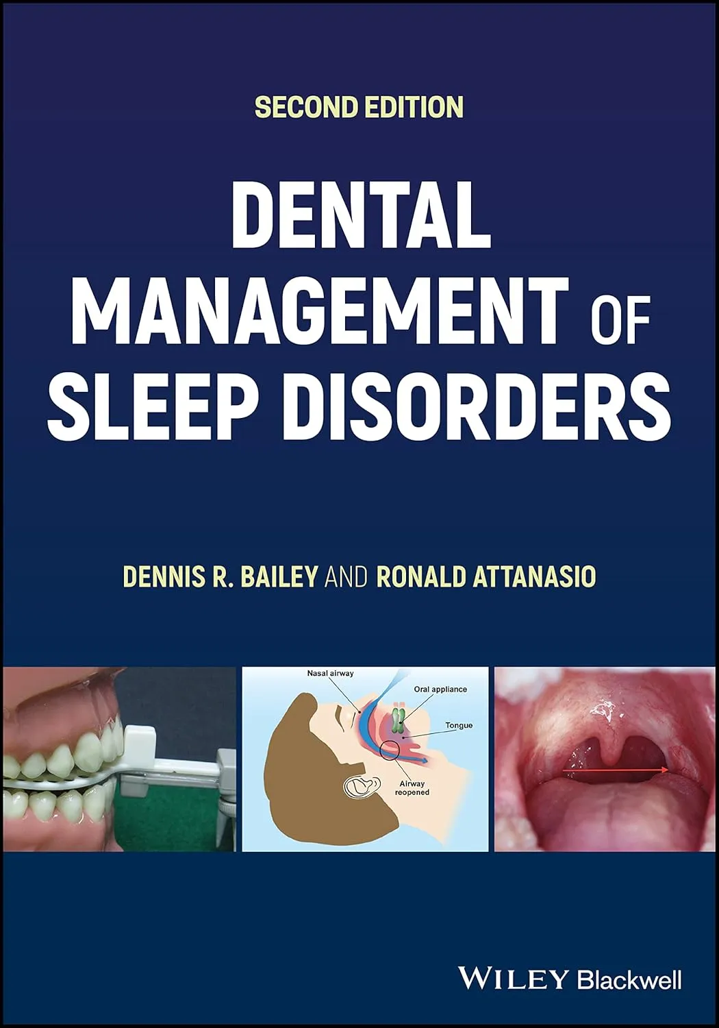 Dental Management Of Sleep Disorders 2nd Edition | Paperback