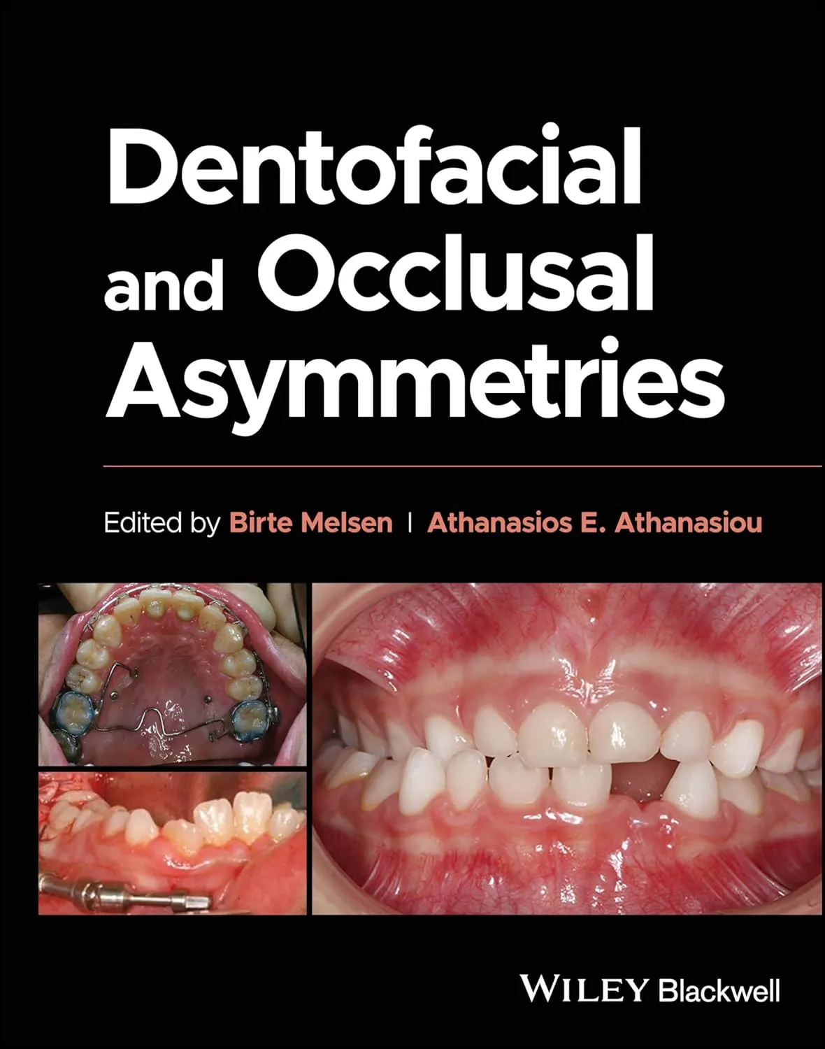 Dentofacial And Occlusal Asymmetries | Hardcover