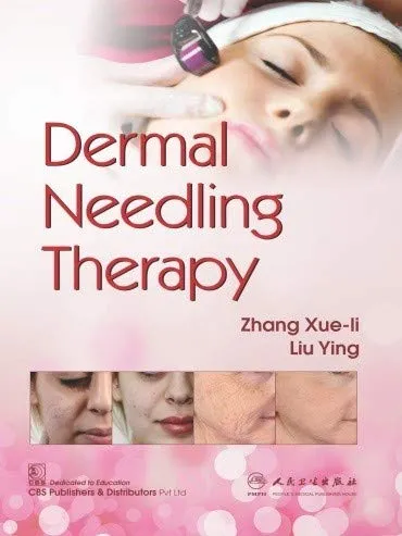 Dermal Needling Therapy | Paperback