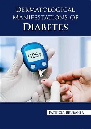 Dermatological Manifestations Of Diabetes | Hardcover