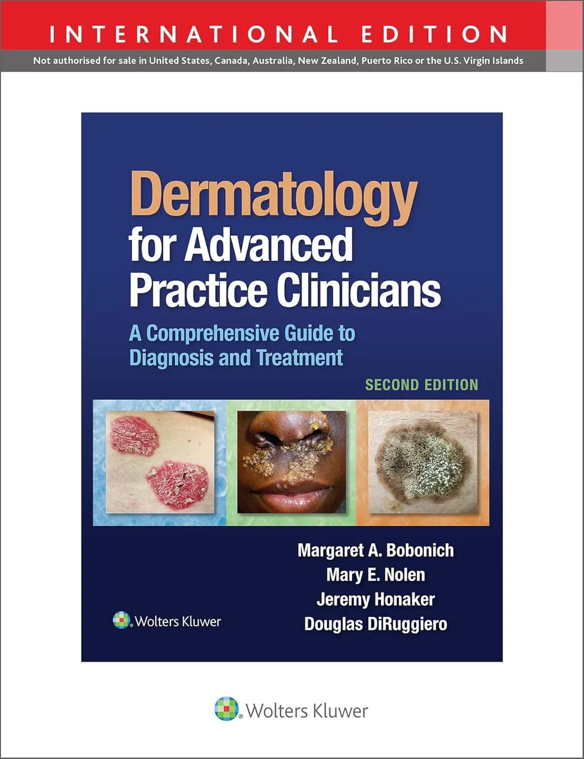 Dermatology For Advanced Practice Clinicians A Comprehensive Guide To Diagnosis And Treatment 2nd Edition (Ie) | Hardcover
