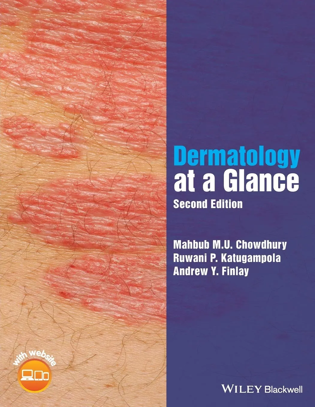 Dermatology At A Glance 2nd Edition | Paperback