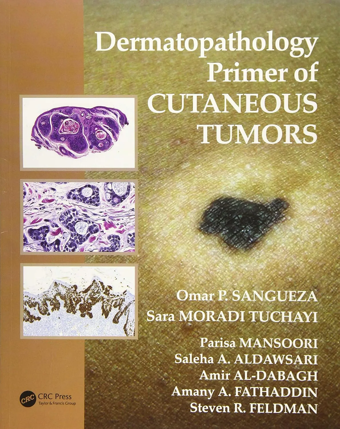 Dermatopathology Primer of Cutaneous Tumors | Paperback