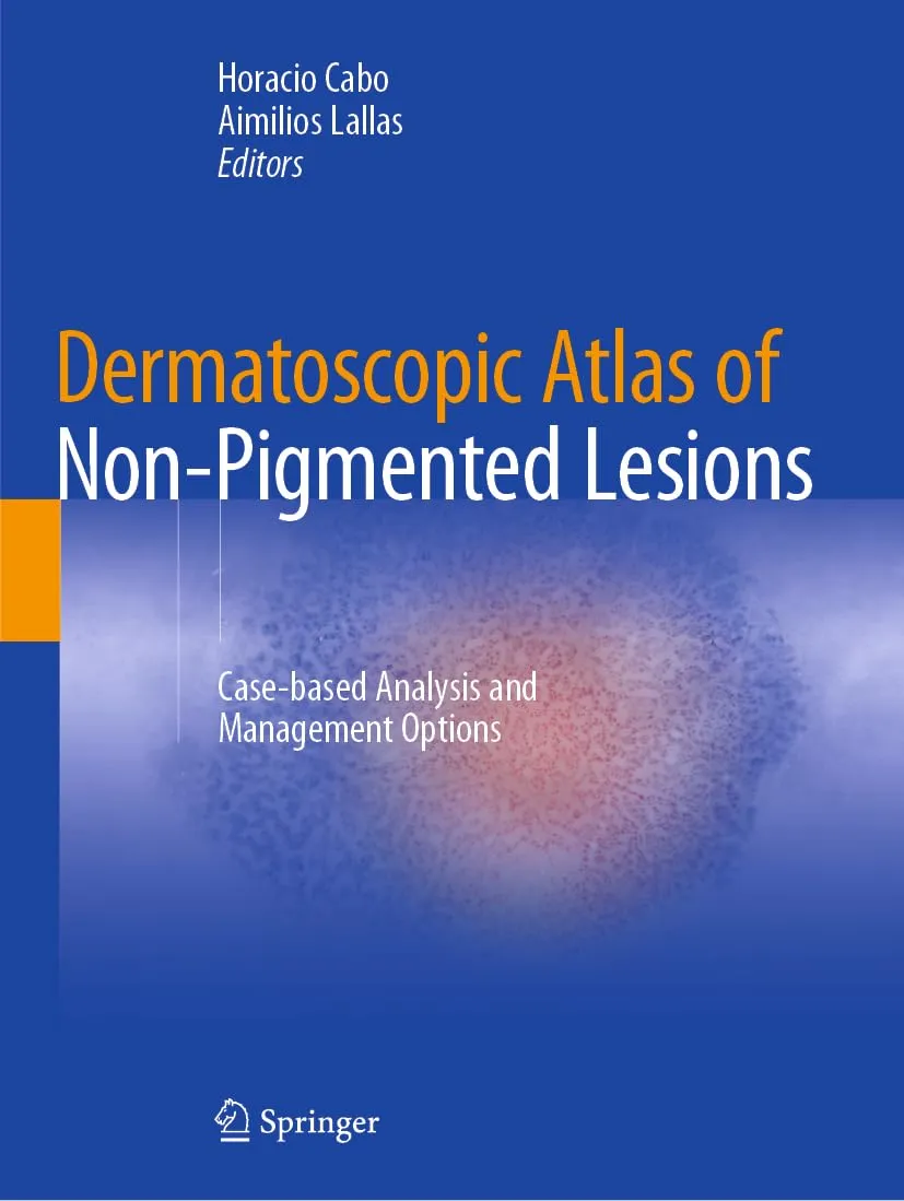 Dermatoscopic Atlas Of Non Pigmented Lesions Case-Based Analysis And Management Options | Paperback