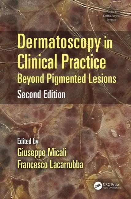 Dermatoscopy in Clinical Practice Beyond Pigmented Lesions | 2nd Edition | Hardcover