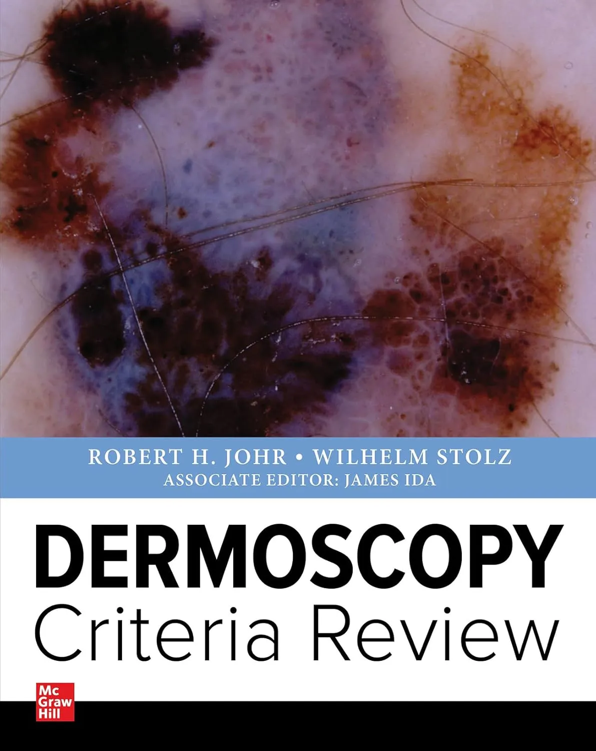 Dermoscopy Criteria Review | Paperback