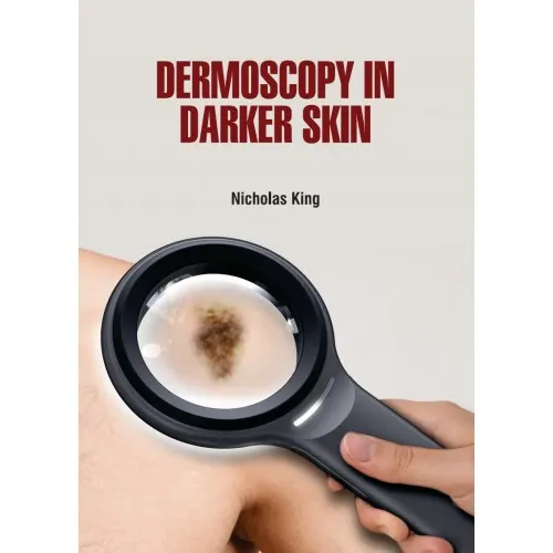 Dermoscopy In Darker Skin | Hardcover