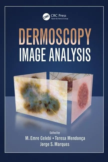 Dermoscopy Image Analysis | Hardcover