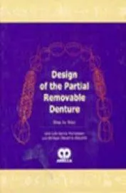 Design of the Partial Removable Denture | Hardcover