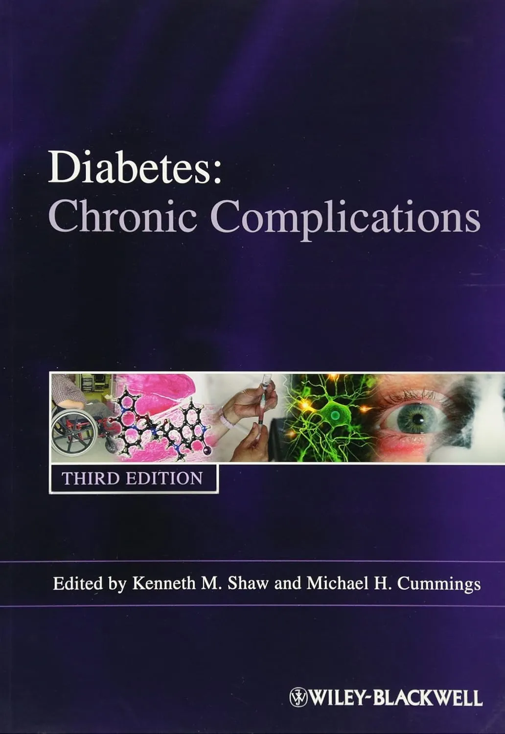 Diabetes Chronic Complications | Third Edition | Paperback