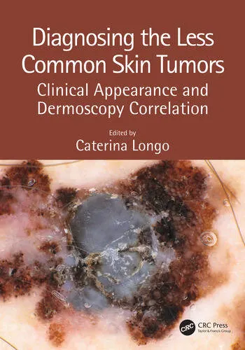 Diagnosing the Less Common Skin Tumors | 1st Edition | Hardcover