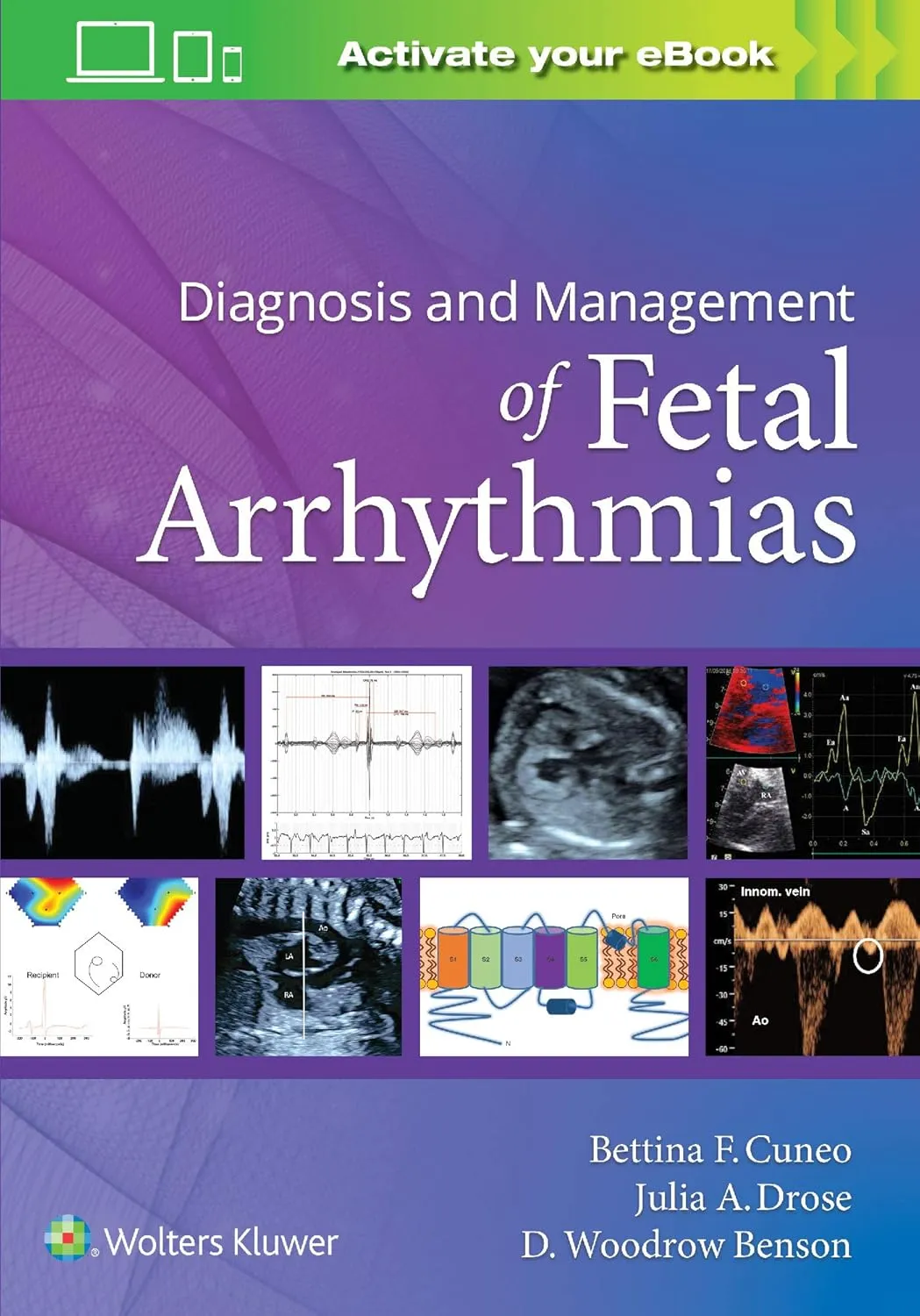 Diagnosis and Management of Fetal Arrhythmias | Paperback