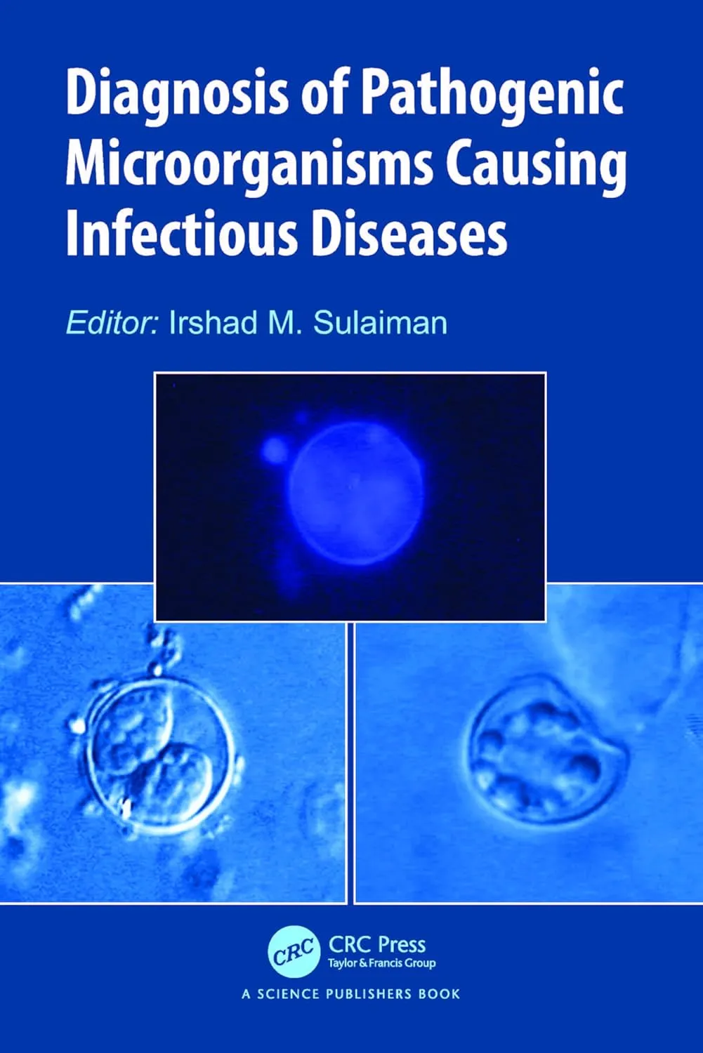 Diagnosis Of Pathogenic Microorganisms Causing Infectious Diseases | Hardcover