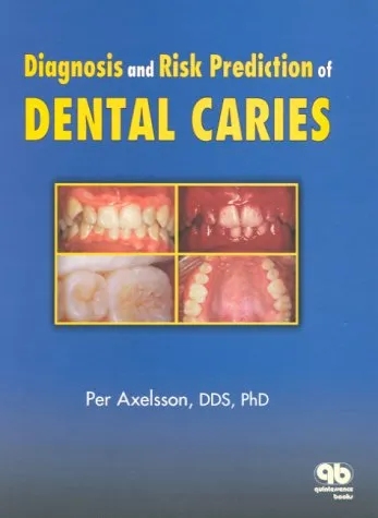Diagnosis and Risk Prediction of Dental Caries | Volume 2 | Hardcover