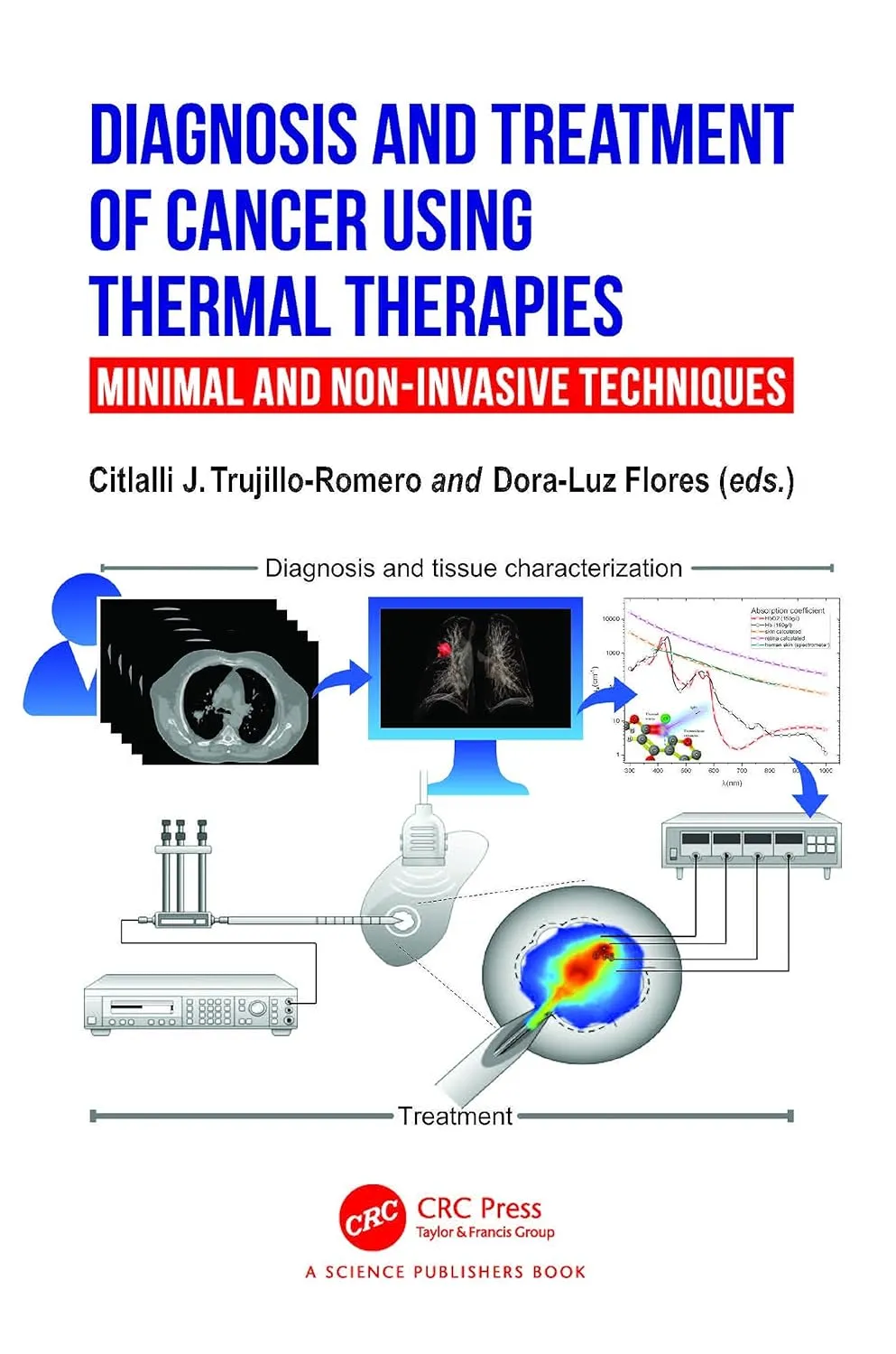 Diagnosis And Treatment Of Cancer Using Thermal Therapies Minimal And Non Invasive Techniques | Hardcover